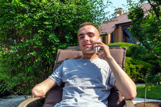 Young caucasian guy with amputated arm talking on the phone while sitting on a sun lounger near his house on the lawn