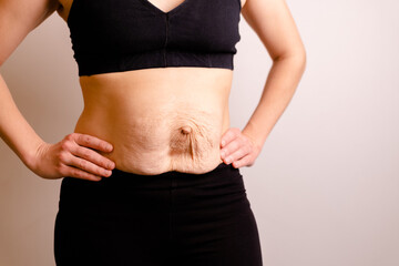 cropped woman dressed in black top and black leggings. Diastasis and umbilical hernia after pregnancy