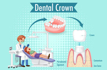Infographic of human in dental crown