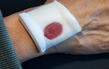 Older male hand, white, with blood-stained bandage.