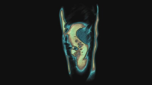 Bulk multicolored CT scan of the abdomen. Computed tomography of the gastrointestinal tract, liver and kidneys
