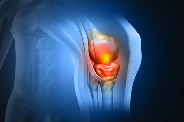 Human knee cross section on medical background