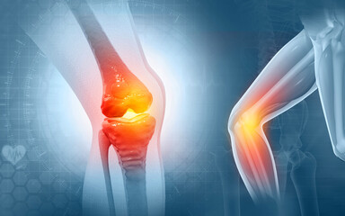 Pain in knee joint. Tendon problems and Joint inflammation on dark background