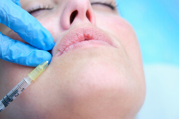 injecting botulinum toxin in the lip