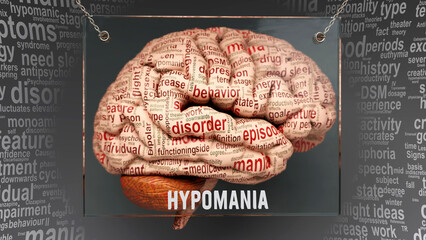 Hypomania anatomy - its causes and effects projected on a human brain revealing Hypomania complexity and relation to human mind. Concept art, 3d illustration