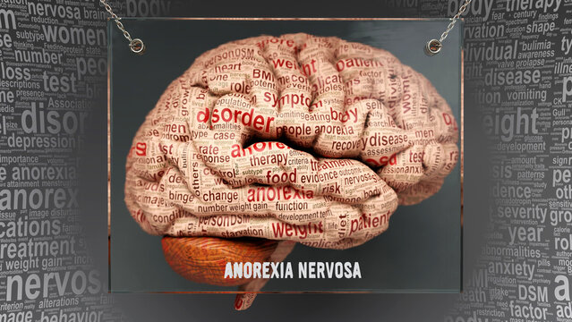 Anorexia nervosa anatomy - its causes and effects projected on a human brain revealing Anorexia nervosa complexity and relation to human mind. Concept art, 3d illustration