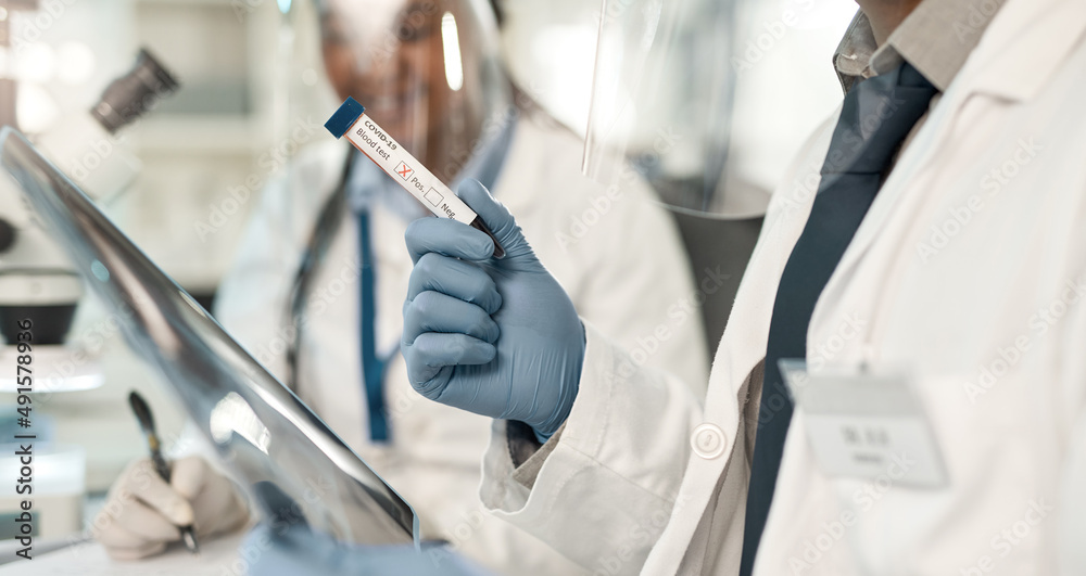 Aufkleber dealing with another positive case. closeup shot of an unrecognisable scientist holding a blood fill