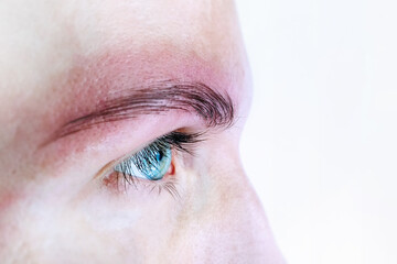 Allergy Eyebrows Permanent Makeup. Allergy rash. Dermatitis problem of rash. Health problem. Permanent tattooing of eyebrows. Cosmetologist applying permanent make up on eyebrows- eyebrow tattoo. - obrazy, fototapety, plakaty
