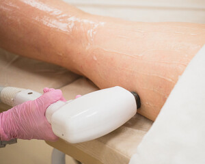 Hair removal on the thighs with a laser - laser hair removal - women beauty salon