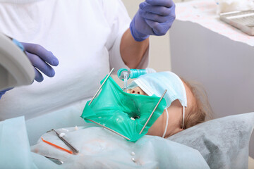 Fototapeta premium Treatment of caries on baby teeth. Modern dental clinic. General anesthesia. Breathing tube. Macro photography. The concept of healthcare.Unrecognizable persons.
