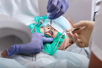 Caries of baby teeth.Treatment of caries under general anesthesia. Modern dental clinic. Breathing...