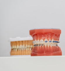 Teeth braces in the artificial jaw.