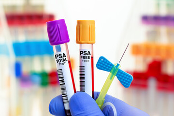 doctor with Blood tubes and needle for PSA Free and PSA Total test in biochemistry lab. Blood...