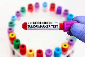 doctor with blood tube labeled with Tumor marker for analysis of cancer biomarkers test. Blood tube for Study of Tumor Marker test in biochemistry lab