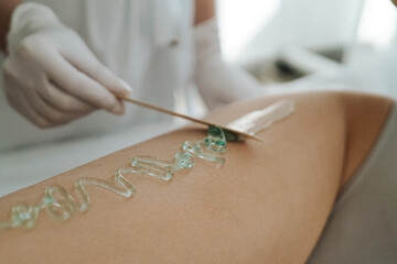 Obraz premium Laser hair removal