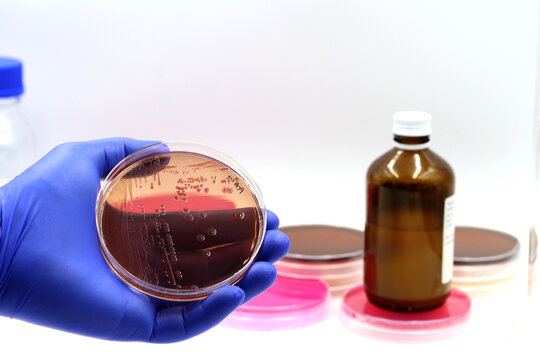 Microbiological culture of intestinal bacteria (enterobacteria, coliforms) in Violet Red Bile agar medium (VRB Agar)