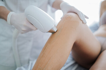 Laser hair removal