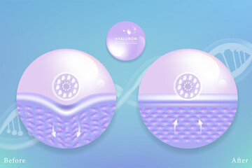 Hyaluronic acid before and after skin solutions ad, purple collagen serum drops with cosmetic advertising background ready to use, illustration vector.