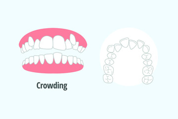 icon dental problem. vectorial illustration  Crowding