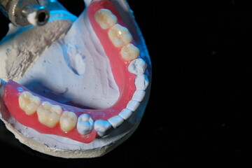 Dentist hand with medical rubber glove holding removable partial denture on white background.