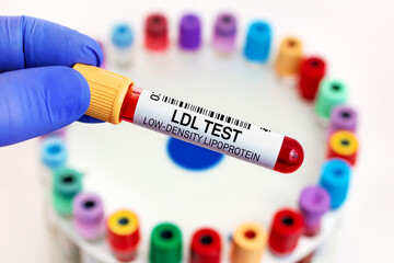 Fototapeta premium doctor with Blood tube for LDL Low Density Lipoprotein test for analysis levels of cholesterol. Blood sample of patient for Low Density Lipoprotein LDL test in laboratory