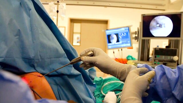 Wide-angle Real Shoulder Arthroscopy Orthopedy Operation By Surgeons Against Lens Blur Background With Endoscopy Monitor.