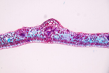 Host cells with spores (mold) are inside wood under the microscope for education.
