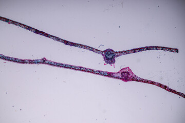 Host cells with spores (mold) are inside wood under the microscope for education.
