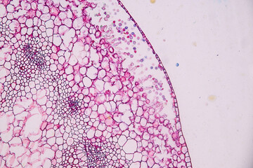 Host cells with spores (mold) are inside wood under the microscope for education.
