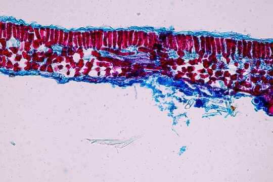 Host cells with spores (mold) are inside wood under the microscope for education.
