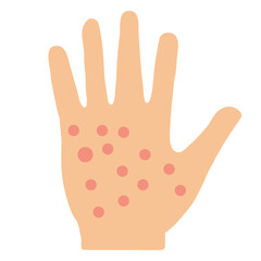eczema hand skin icon on white background. allergic reaction symbol. irritation on hand sign. flat style.