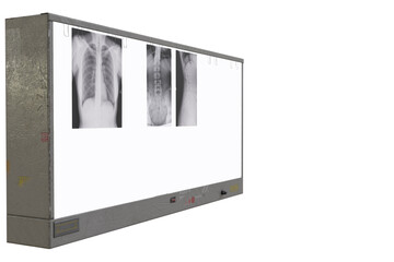 x-ray film viewer isolated on white