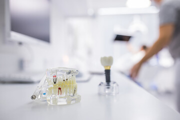 Female medical expert pointing at dental implant in glass tooth
