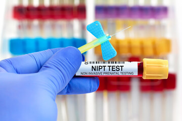 doctor with Blood tube and catheter for NIPT Non invasive Prenatal Testing for antenatal screening test. Blood sample of patient for Non invasive Prenatal Testing test NIPT in laboratory