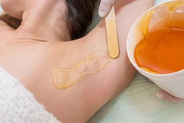 Depilation and epilation female armpit with liquid sugar paste by spatula. Hand of cosmetologist...