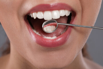 Examining woman's teeth with dentist's mirror on grey background, closeup