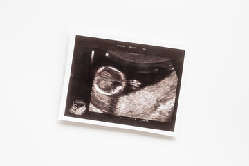 Prenatal ultrasound screening of unborn baby. Pregnancy background