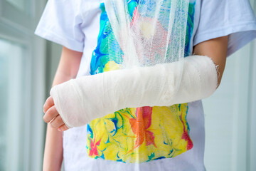 Close-up of a broken arm of a child in a cast. The girl holds her hand folded against the...