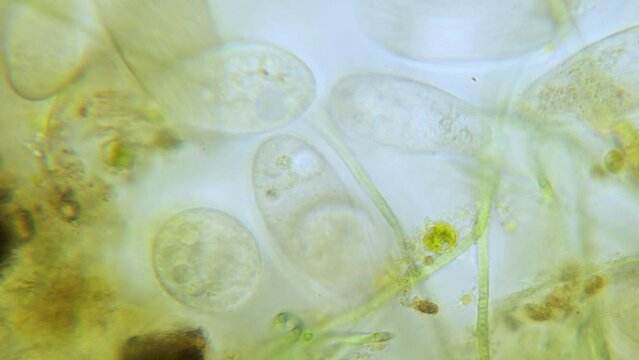 Paramecium high density population in microscope bright filed