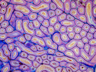 rabbit epididymis cross section under the microscope showing spermatozoa inside its tubes - optical microscope x100 magnification