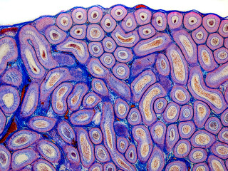 rabbit epididymis cross section under the microscope showing spermatozoa inside its tubes - optical microscope x100 magnification