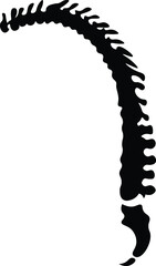 Shillouete of Ankylosing Sponydilitis bend spine deformity arthritis