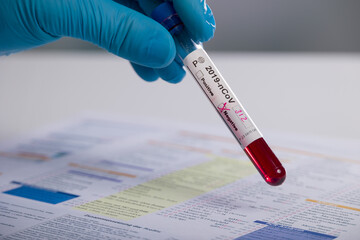 a hand in medical gloves is handling a probe in front of a request form for analysis