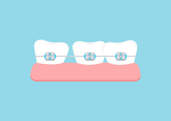 Crooked teeth with dental braces in gym. Dental braces on misaligned white tooth with gap orthodontic bracket correction treatment concept. Vector flat design dentistry illustration.