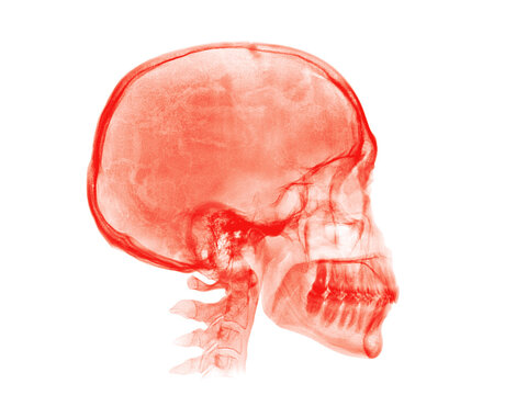 Human skull. Red X-ray image on white background