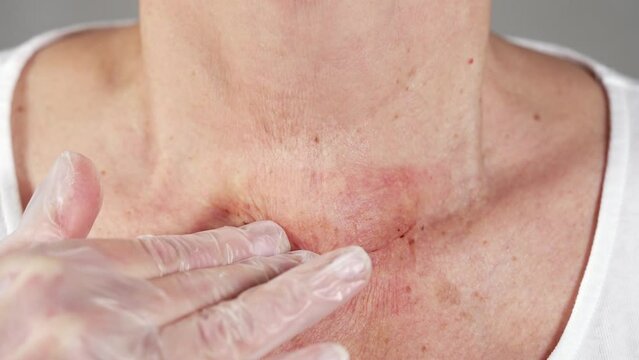 Elderly woman touching her throat with a gloved hand in a sterile glove in a close up view