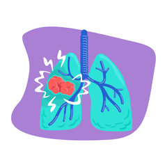 Lung cancer 2D vector isolated illustration. Diagnozing dangerous conditions flat sticker on cartoon background. Health complications colourful scene for mobile, website, presentation