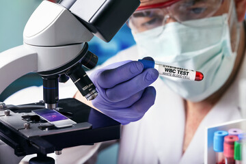doctor with Blood tube for WBC White Blood Count test in the hematology lab. Blood sample of...