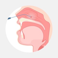 Deviated Ear ENT CPAP nose stop apnea block laser nasal RAVOR RFVTR runny sinus sleep treat airway concha device mucous polyps septal septum throat tissue airflow air way bullosa drip allergic