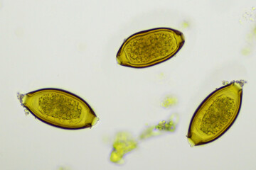 Egg of Trichuris trichiura (whipworm) in human stool, analyze by microscope, original magnification...